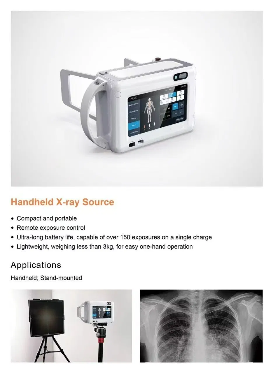 Handheld X-ray Detail