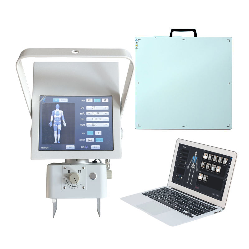 High-Precision Medical X-ray Equipment for Patient Care Solutions