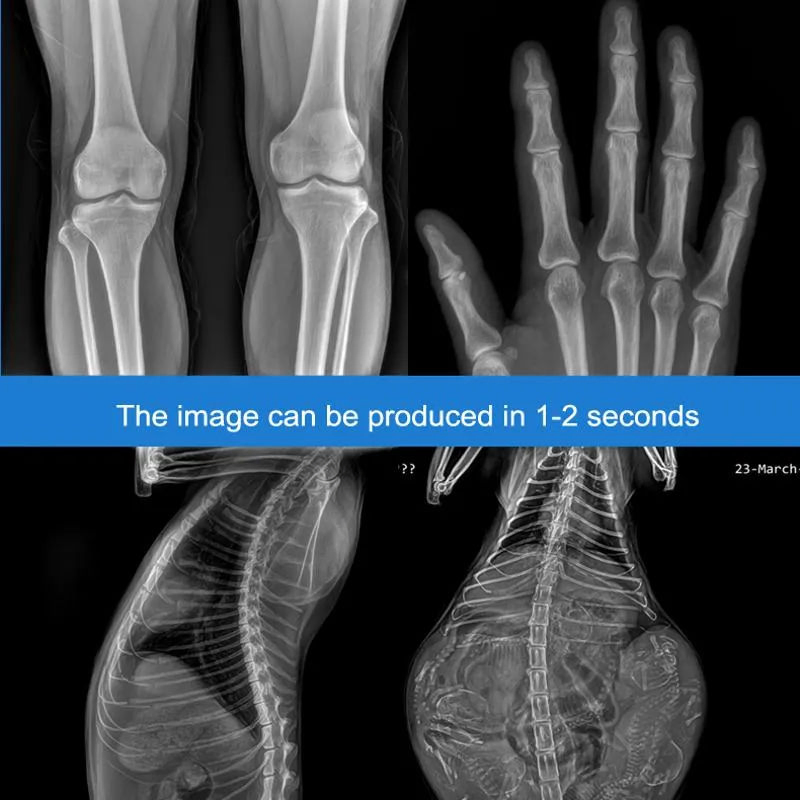 Xray Machine Medical Wireless Dr Panels Digital Radiography System Dr Equipment for Hospital Diagnosis