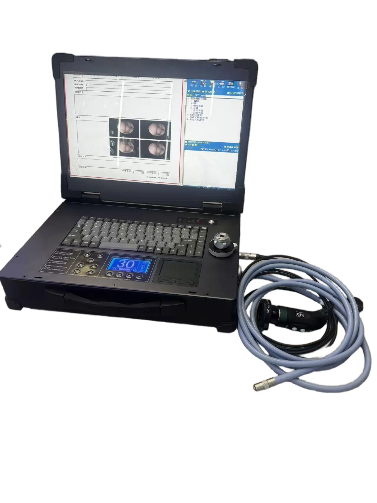 Dual-Mode HD Portable Camera System Built-in Printing Function &amp; Workstation for Diagnostic