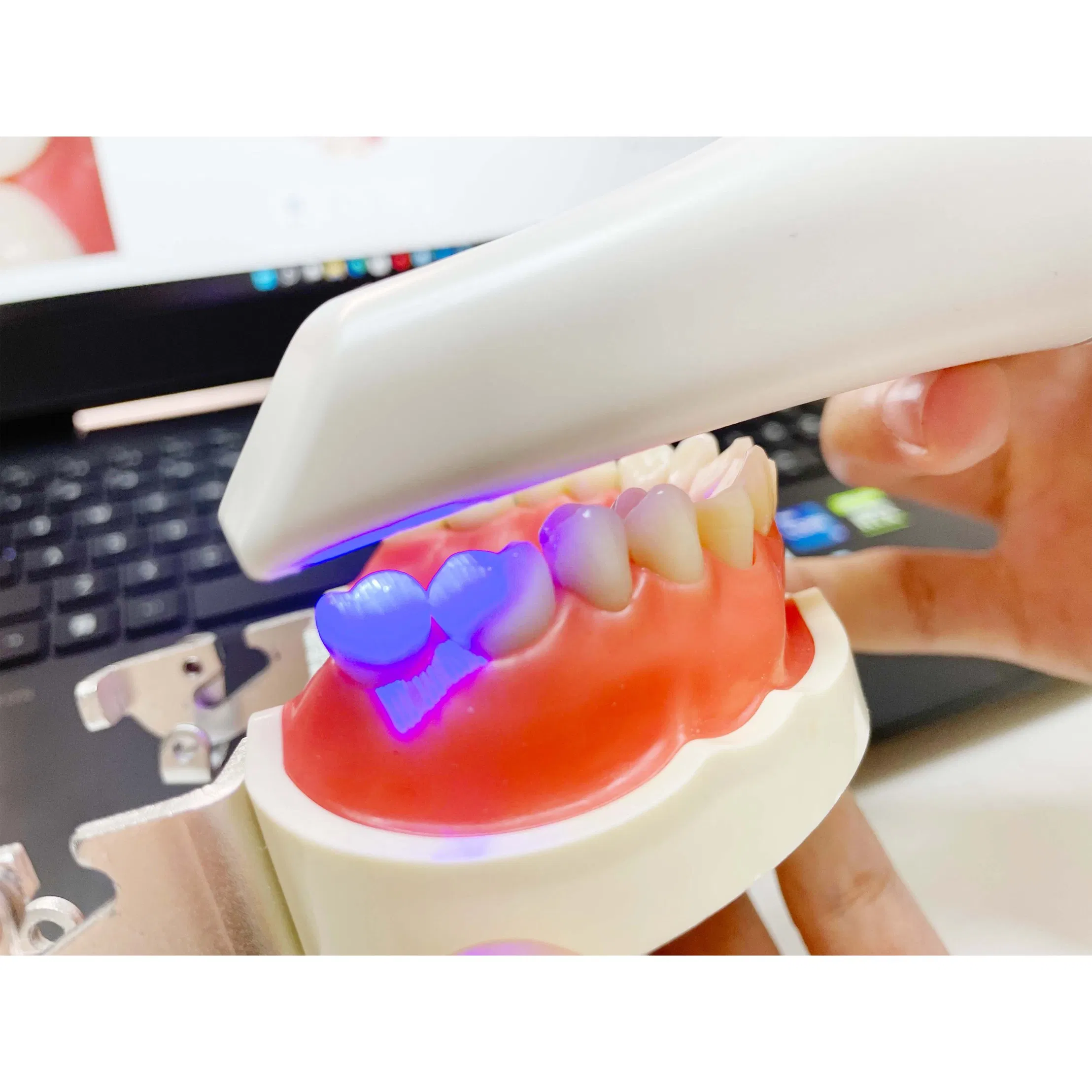 High Definition Scanning Image Oral Dental Scanner Convenient Dental Diagnostic Equipment