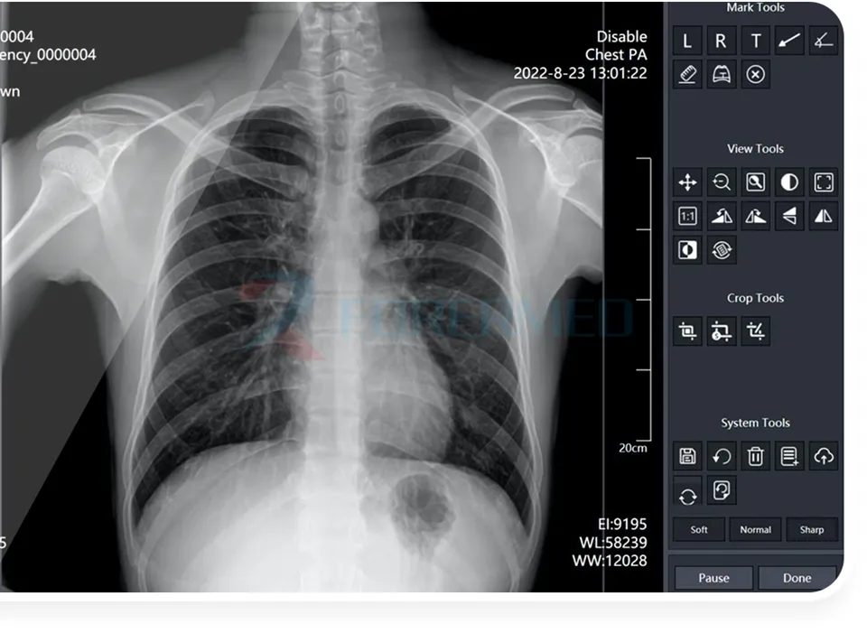 X-ray Image Sample 1