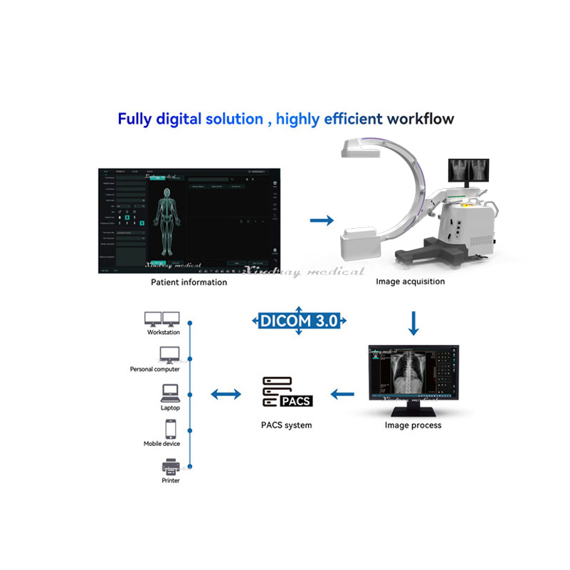 Hospital Medical High Frequency Mobile Surgical C-Arm Digital X-ray Equipment