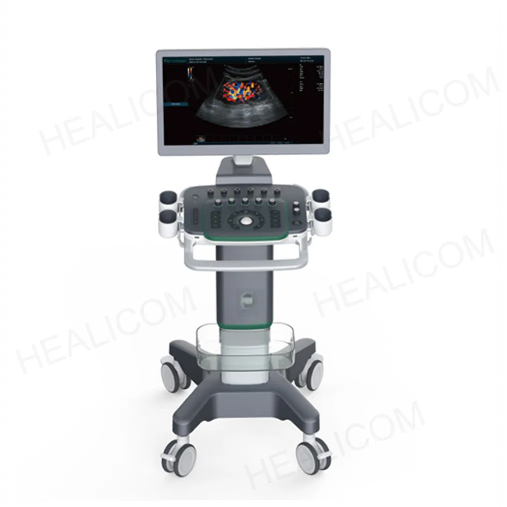High Resolution All Digital Color Doppler System 4D Real-Time Imaging Medical Ultrasound Scanner with Dual Screen
