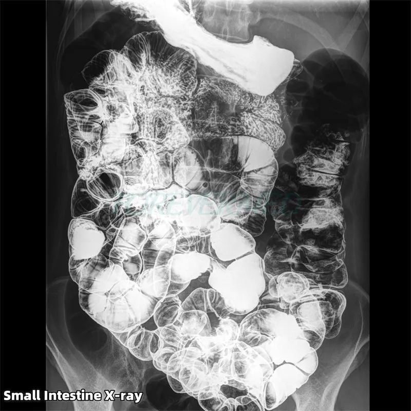 Digital X-ray Component 3