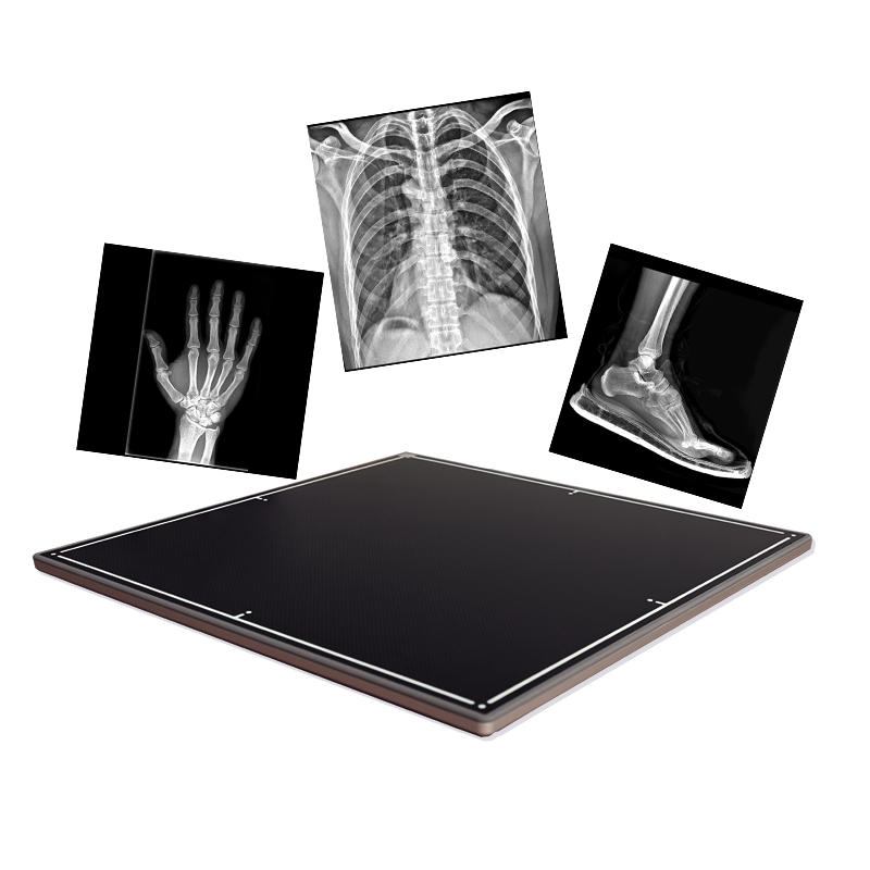 High-Tech Medical X Ray Machine Medical Diagnosis Equipment for Modern Practices