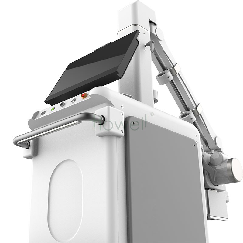 Portable Dr X-ray Digital Radiography System Digital Mobile X-ray Machine