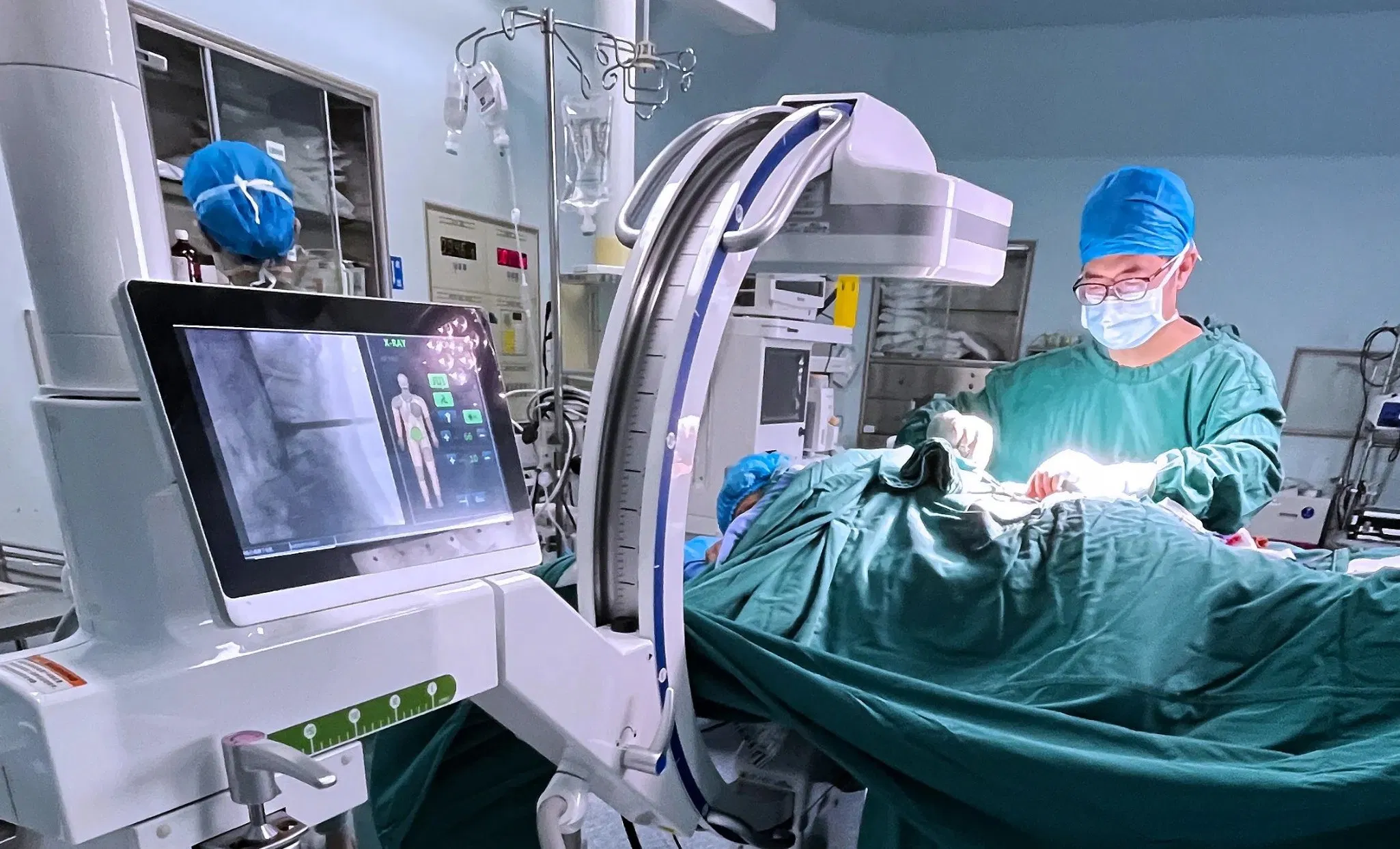 Advanced Mobile C-Arm X-ray System with High-Resolution Imaging Technology