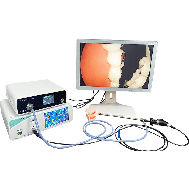 Endoscopic Camera System with 60W LED Light Source and 32 Inch Monitor Easyvistar