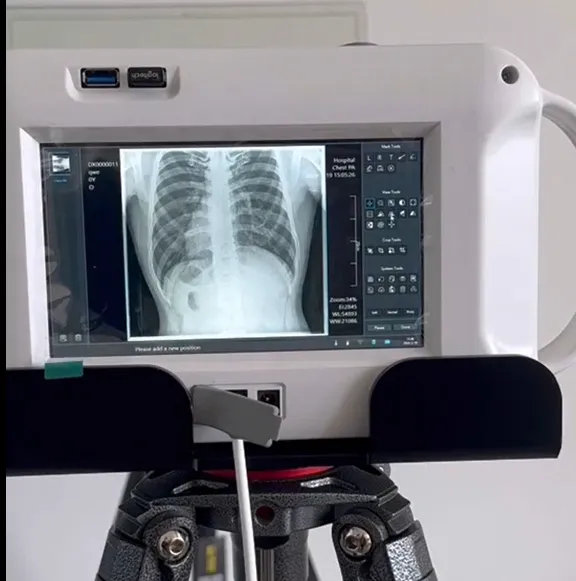 Portable X Ray Device Overview