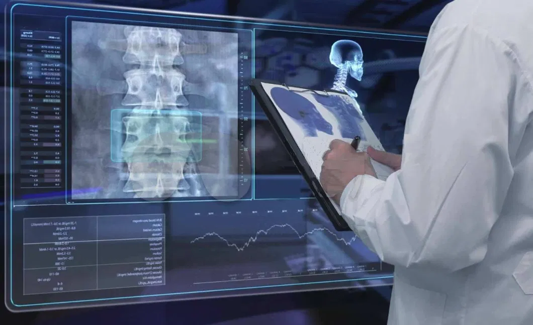 High Frequency Handheld X-ray