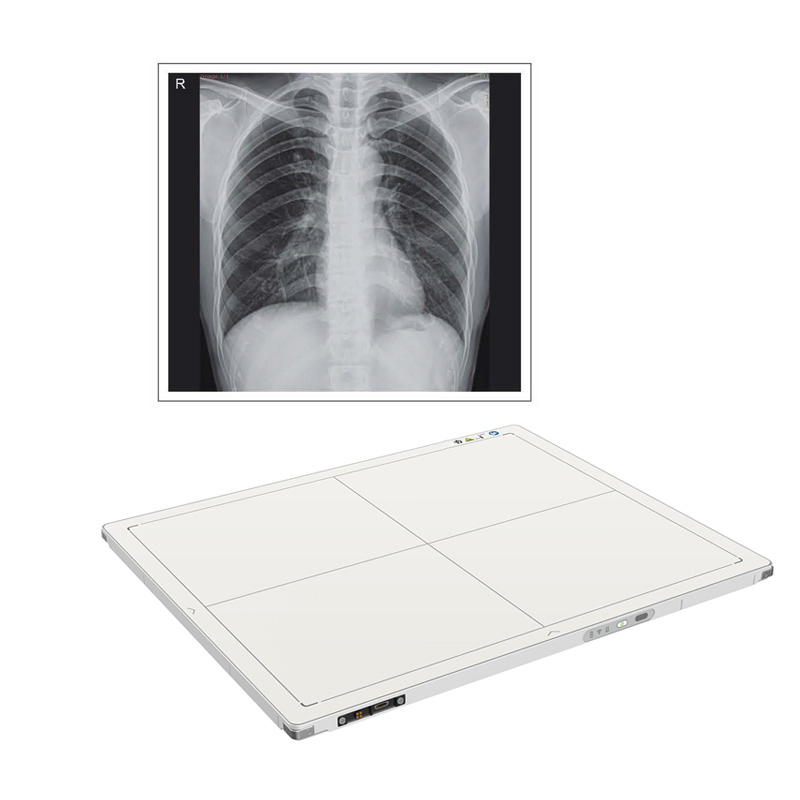 Wireless Digital Flat Panel Detector X Ray for Sale