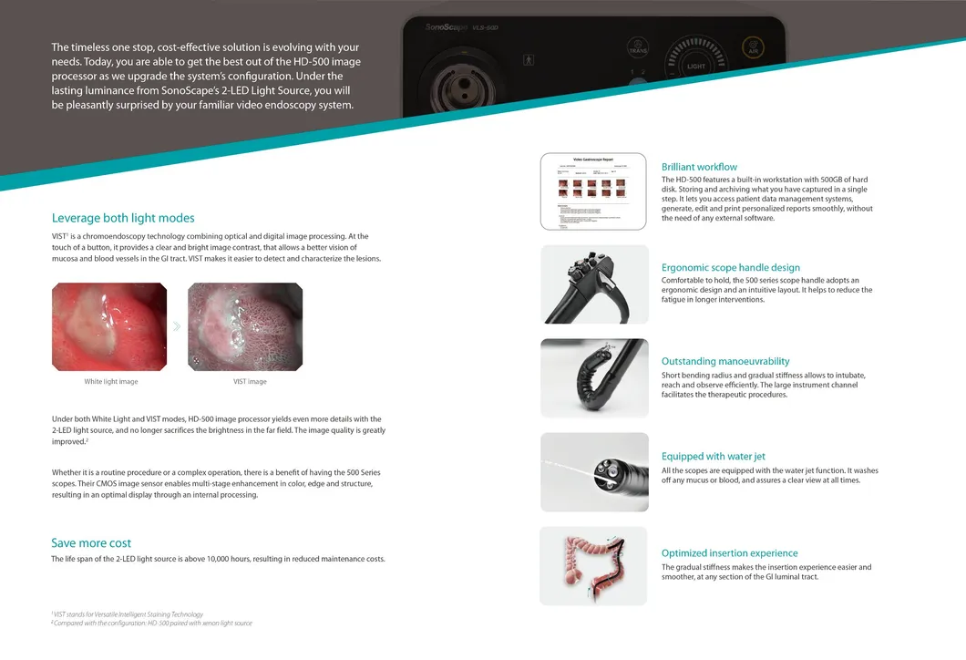 Endoscope System Detail 1