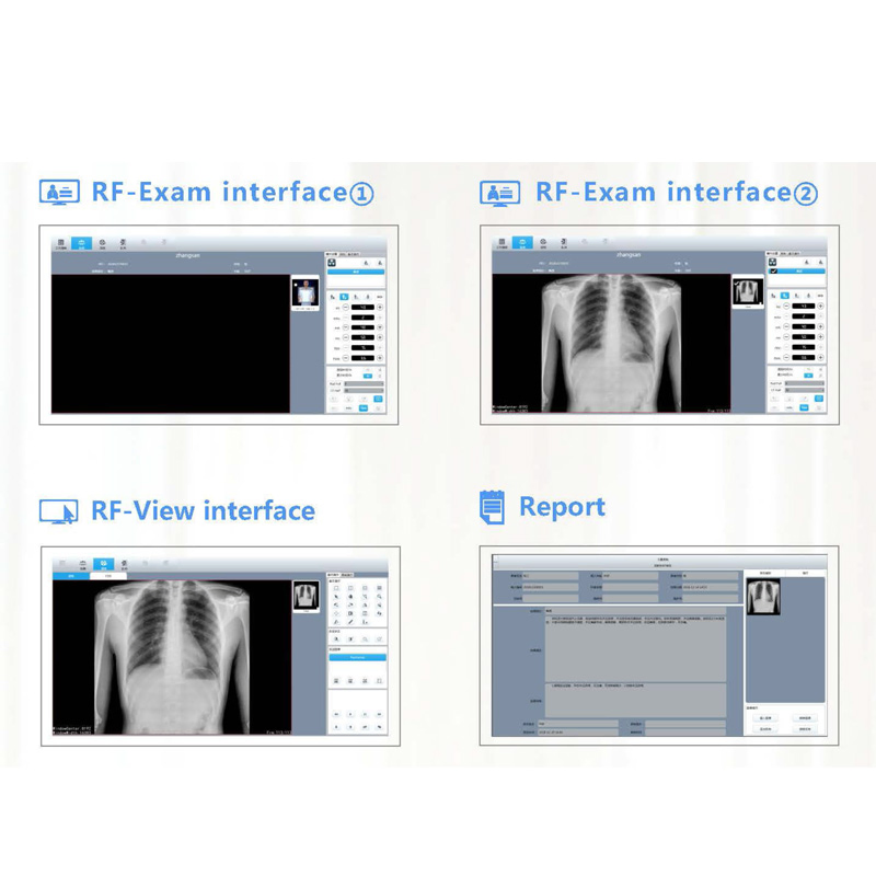X-ray Machine Dr System Acquisition Workstation Software 50kw X-ray