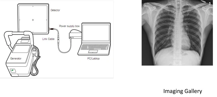 China High Quality My-D019d Hospital Mobile 100mA Digital Xray Portable X-ray Equipment