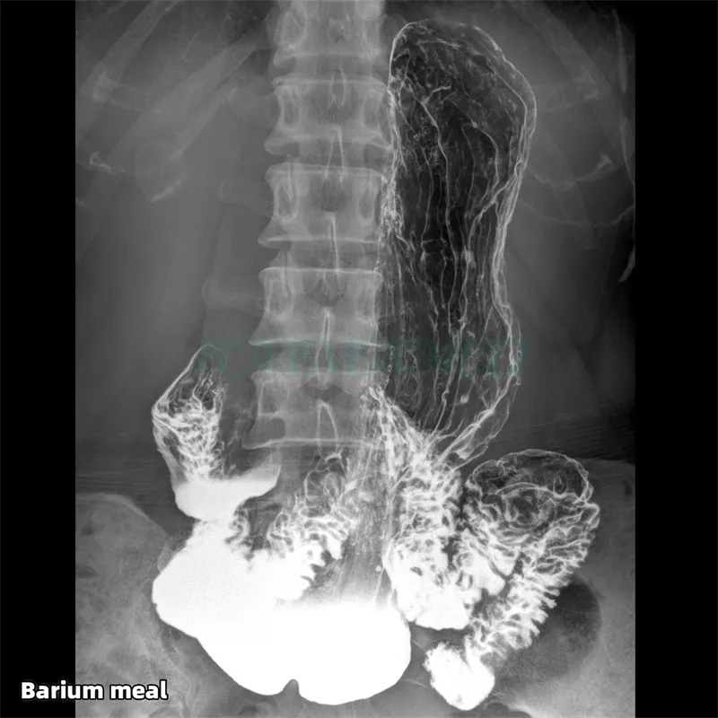 Digital X-ray Component 2