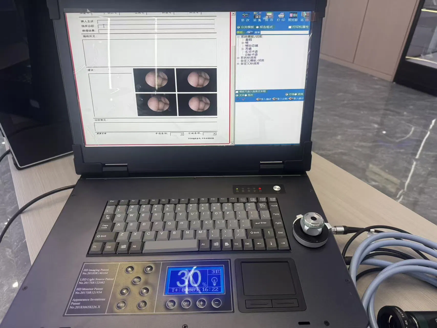 Dual-Mode HD Portable Camera System Built-in Printing Function &amp; Workstation for Diagnostic