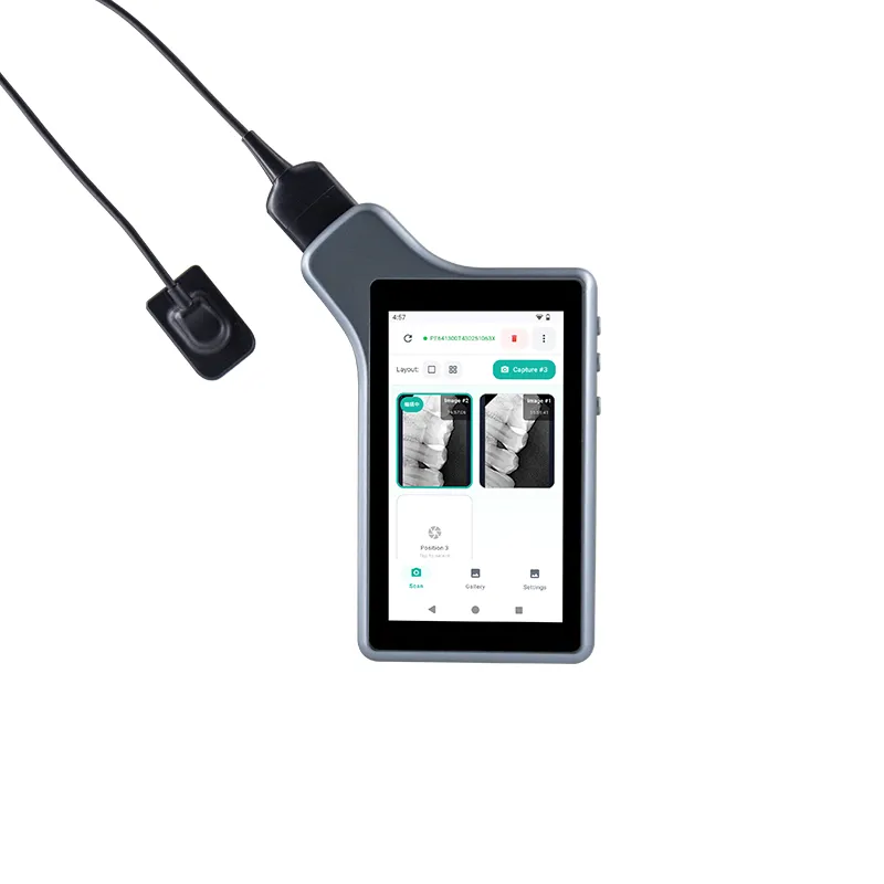Dental Portable Imaging System 6
