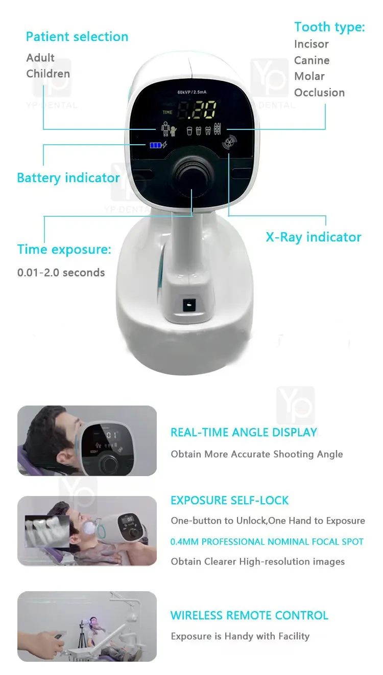 Portable Dental X-ray Device Detail 2