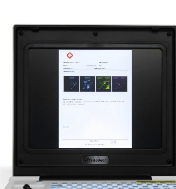 High Resolution Imaging Equipment: Compact and Portable Ultrasound Solution