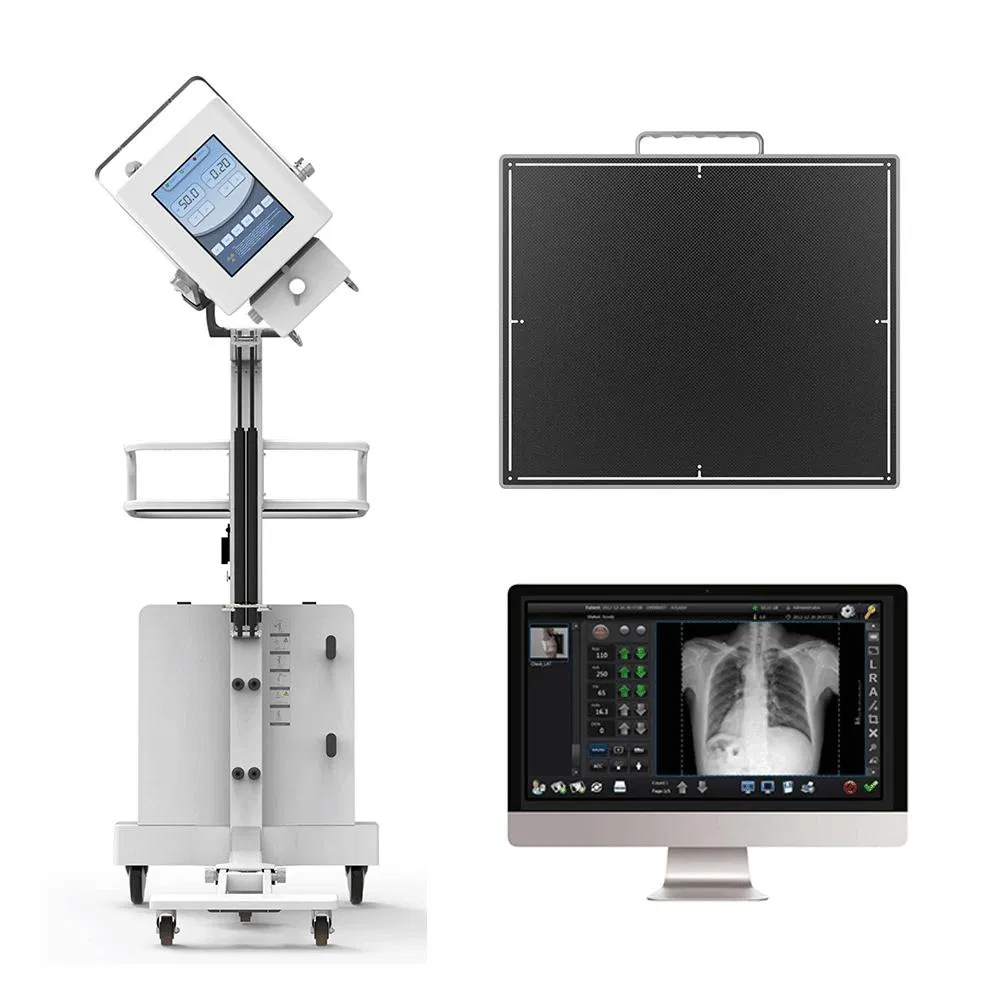Careray Medical Mammography Diagnostic Portable 17"17" Wireless Dr X Ray Flat Panel Detector