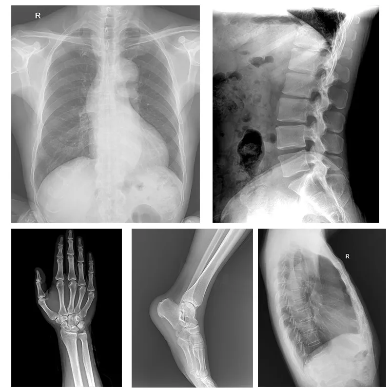 X-ray Machine View 4