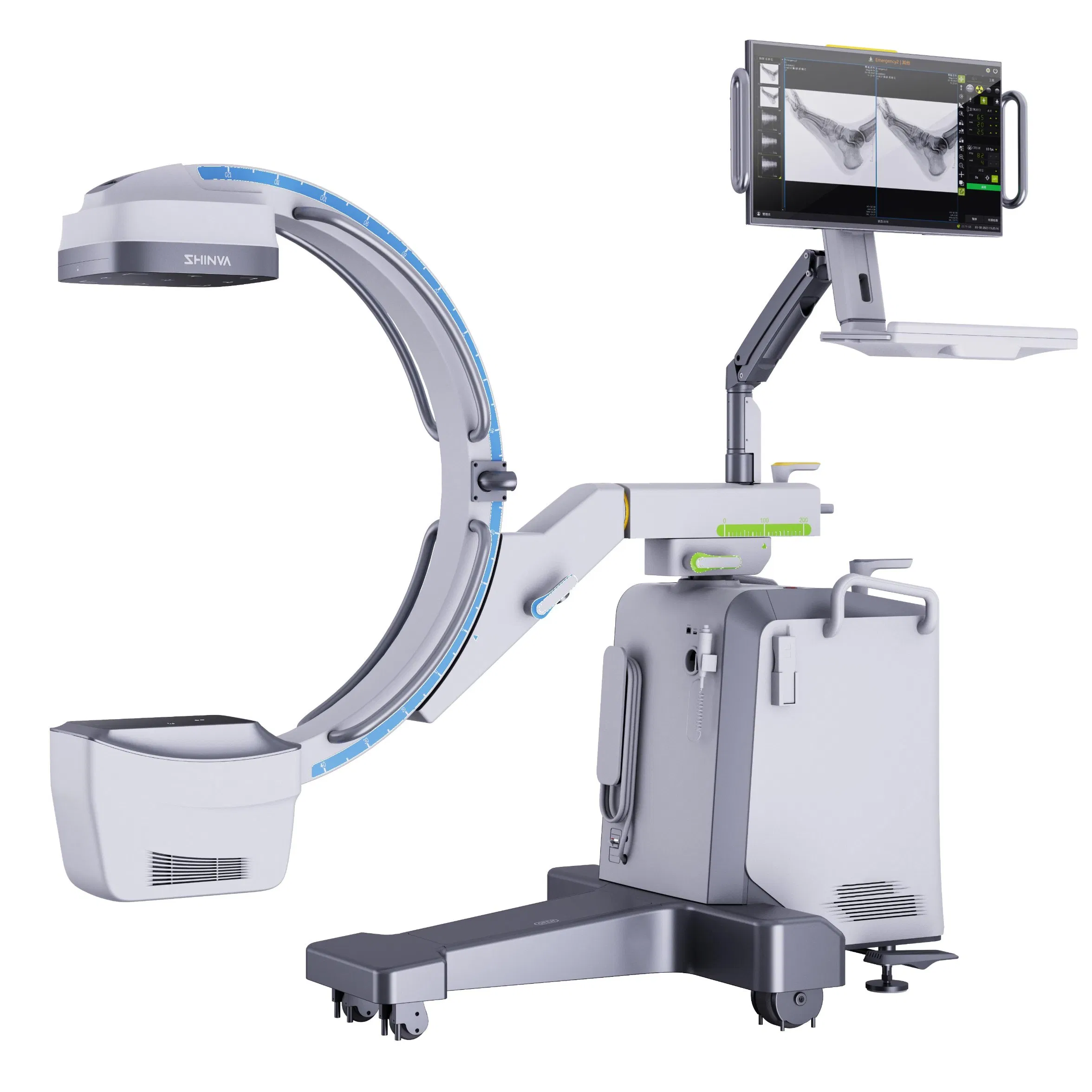 Digital C-Arm X-ray System for Accurate Medical Diagnosis