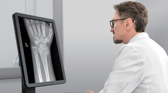 Mindray Digieye 330 Professional Digital Medical X-ray Radiography System