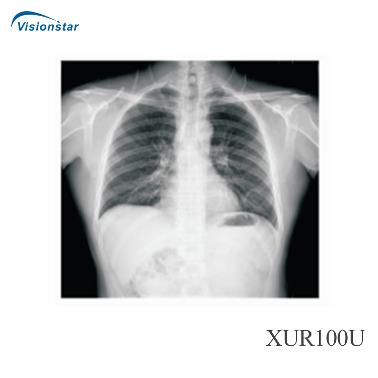 Xur100u Hospital Small Space Occupation High Freqency Radiography Photography Dr Dynamic UC Arm Digital X-ray System