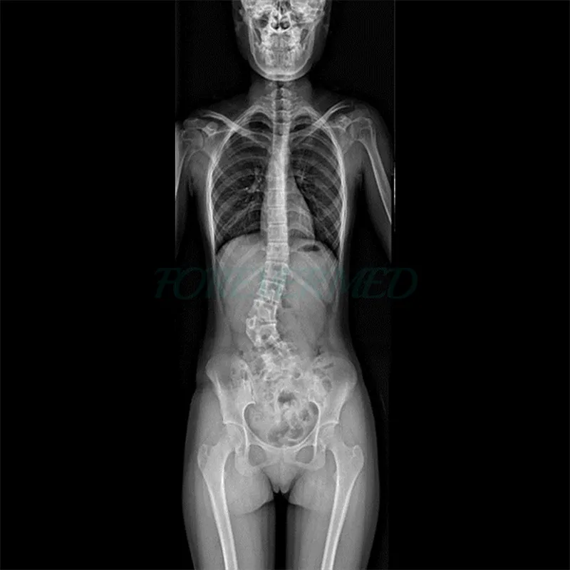Digital X-ray Component 4