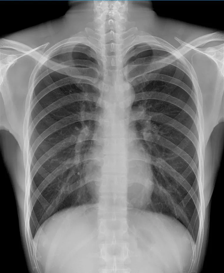 X-ray Image 2