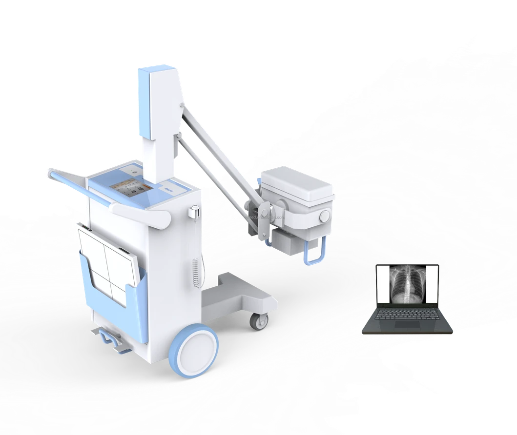 Digital X-ray Equipment