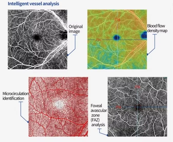 OCT Imaging Analysis