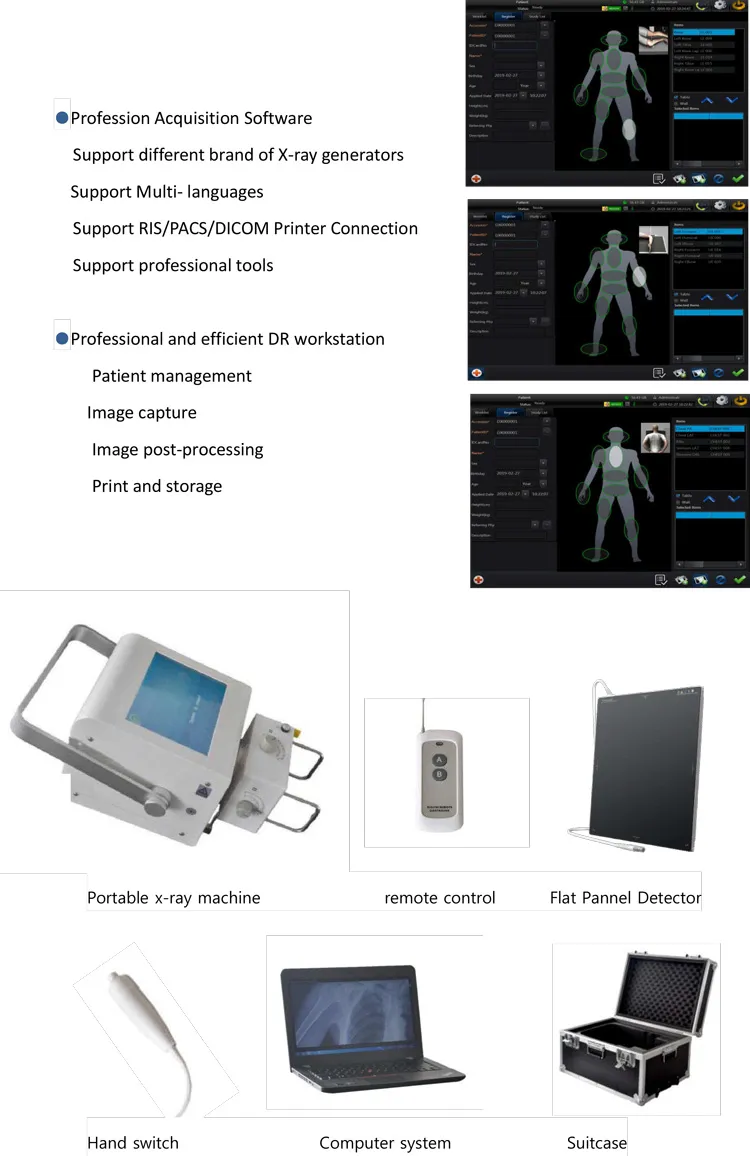 X-ray Machine Detail 2