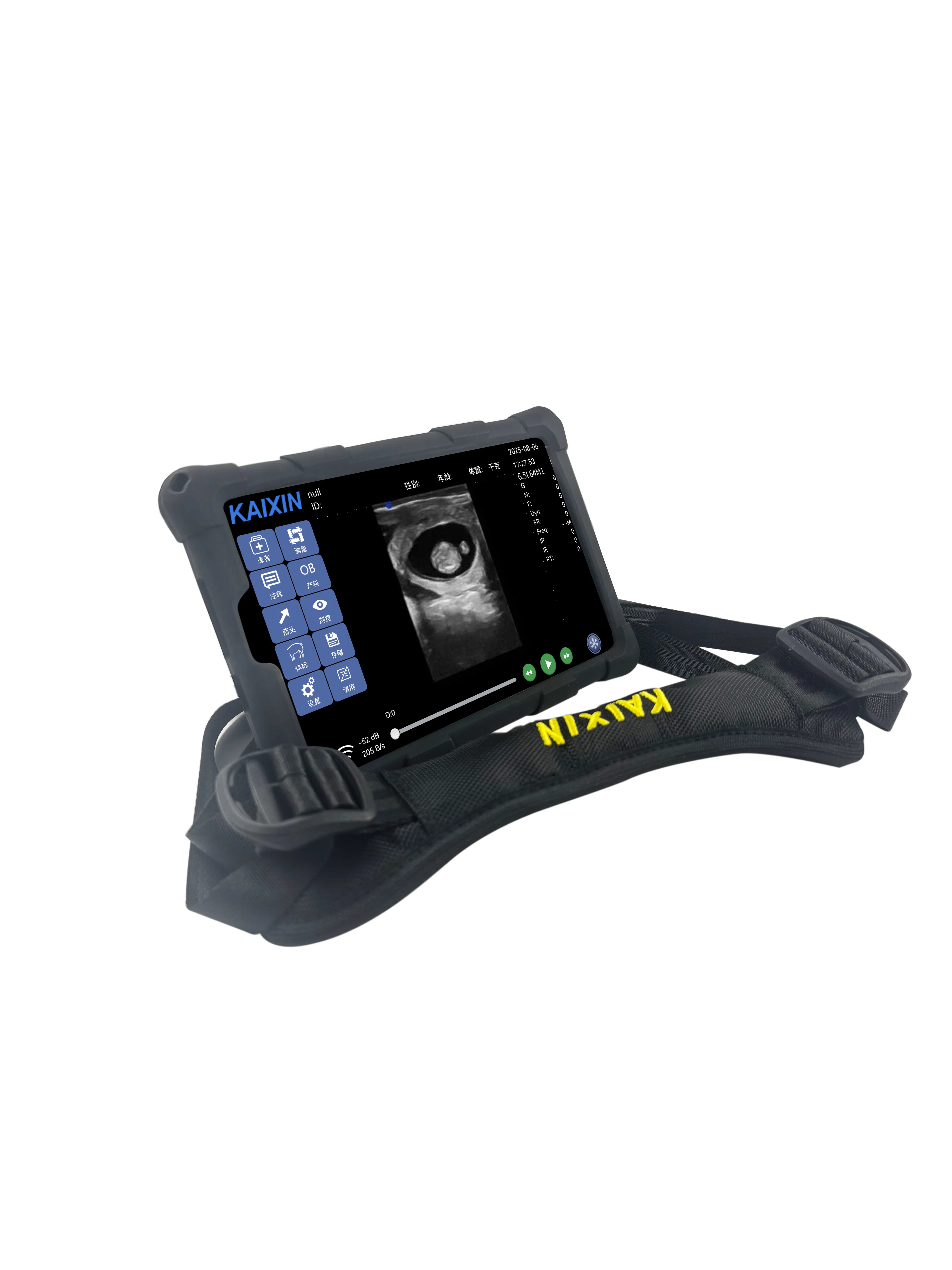 K1 Wireless Veterinary Ultrasound Scanner - Veterinary Imaging Solution by Kaixin