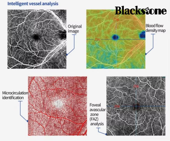 Velite C800 CE-Certified Intelligent Oct Diagnostic System