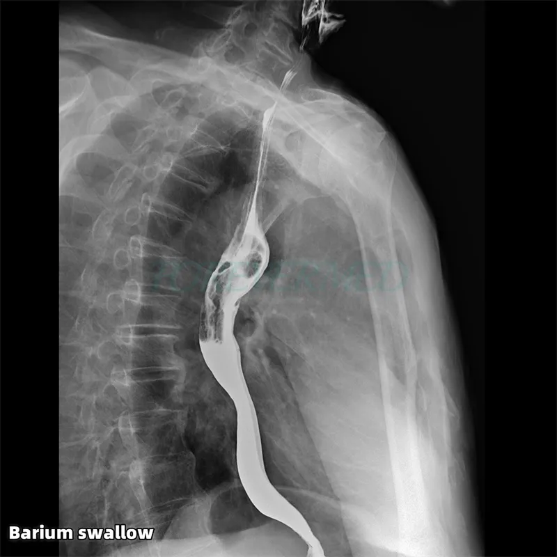 Digital X-ray Component 1