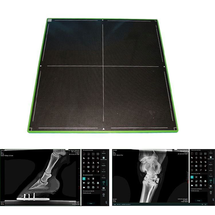Medical Equipment Careview 1800cw 17''*17'' Wireless X-ray Flat Panel Detector Panel Detector