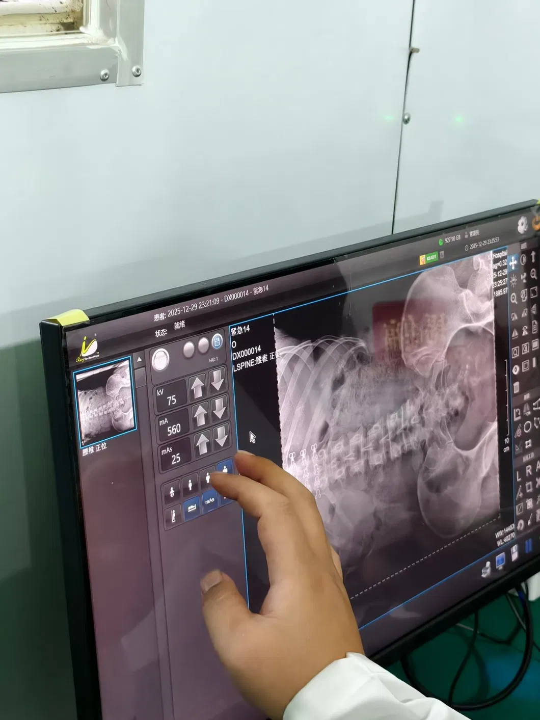 Radiography detail 2