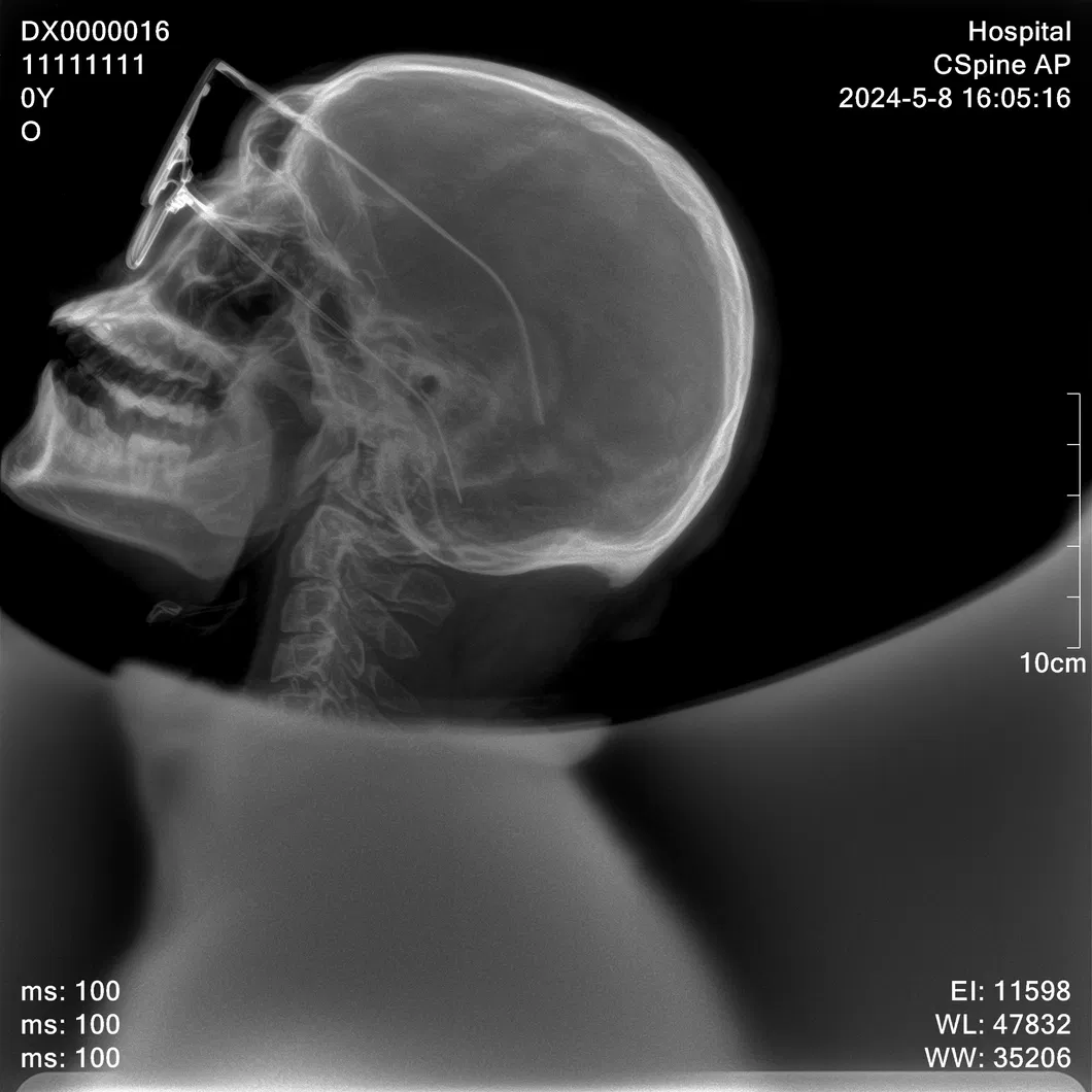 X-ray Image Sample 3