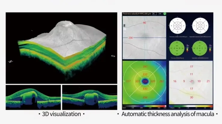 Diagnostic Interface