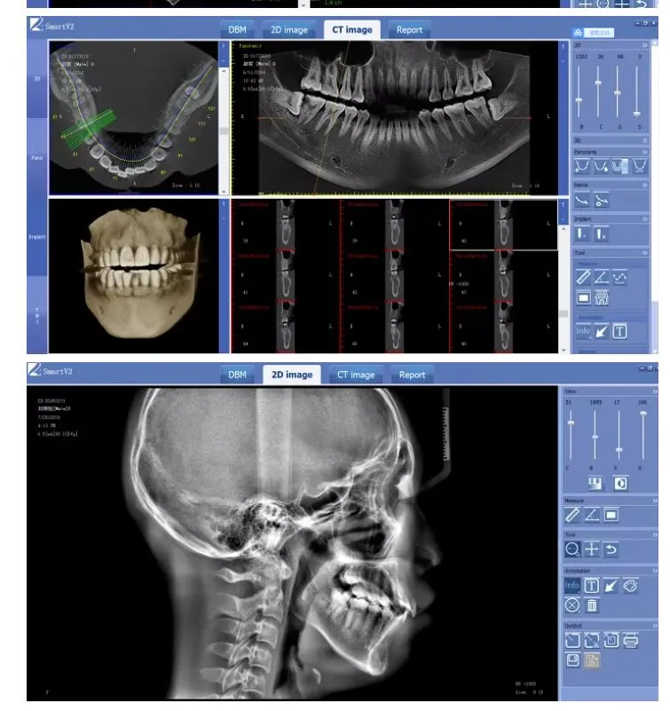 Dental Imaging Detail