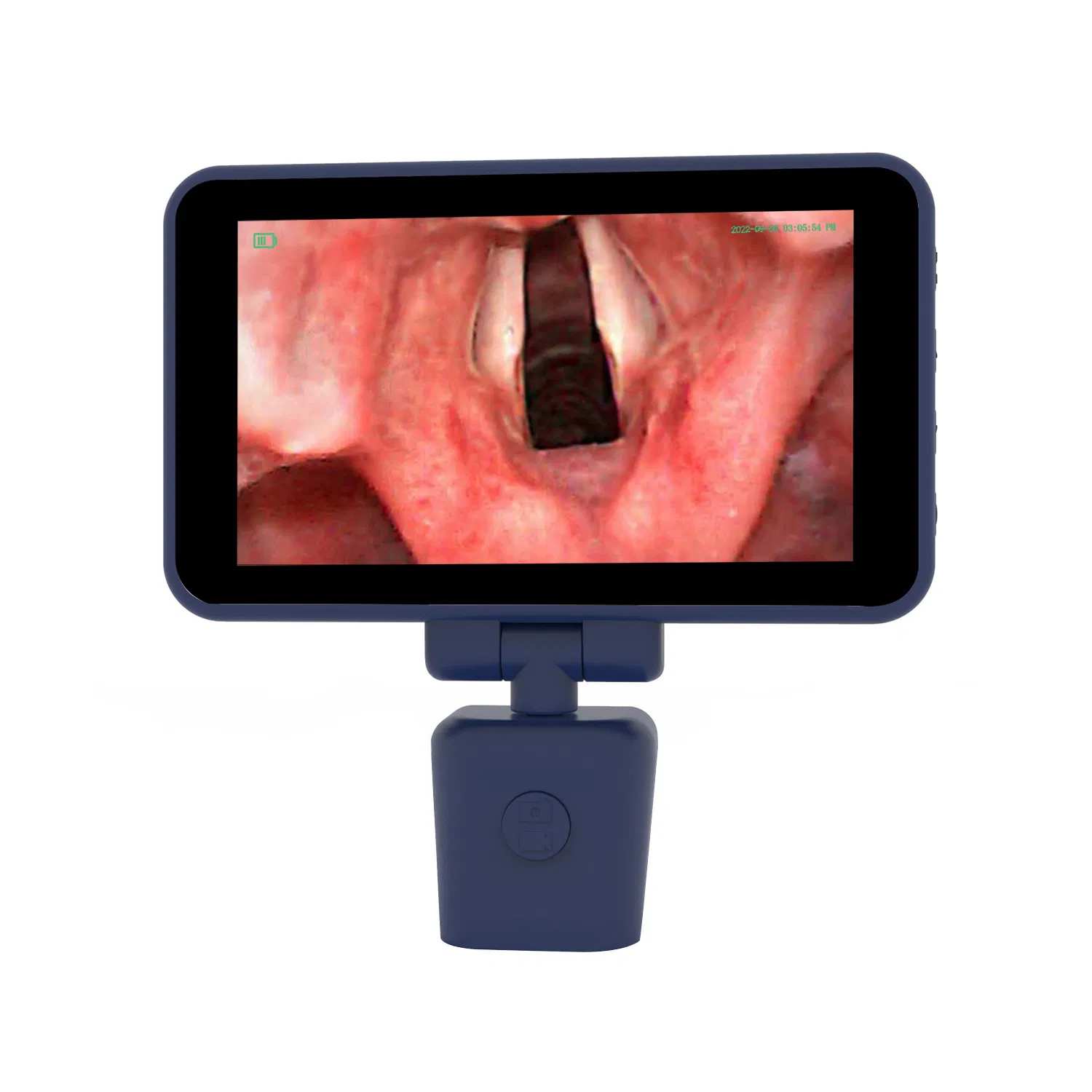 Versatile Endoscope System for Safe Airway Intubation Procedures