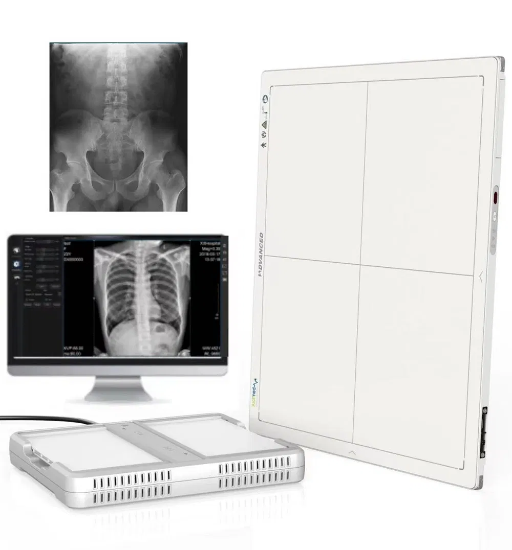 Medical Equipment Digital Flat Panel Detector X Ray Machine Wire and Wireless Flat Panel Detector 17''x17'' for Veterinary and Human Promotion Price