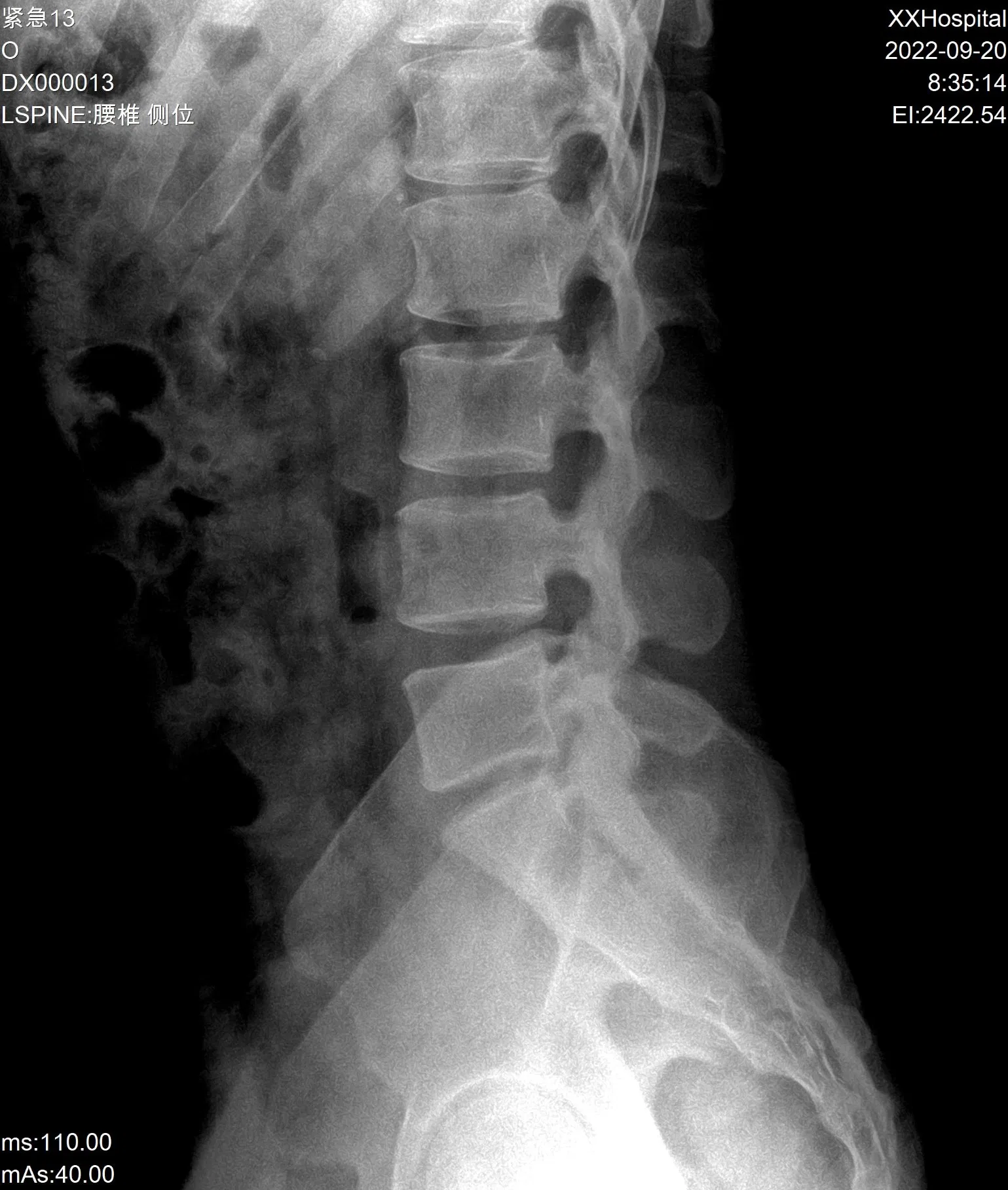 Digital X-ray Radiography System Dr with Affordable Cost