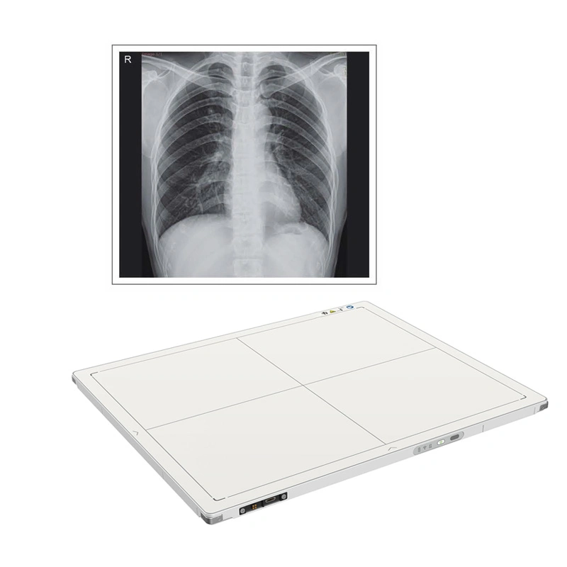 Factory Price Xray Dr Fpd Wireless Csi Rx Digital X-ray Flat Panel Detector for Human and Veterinary