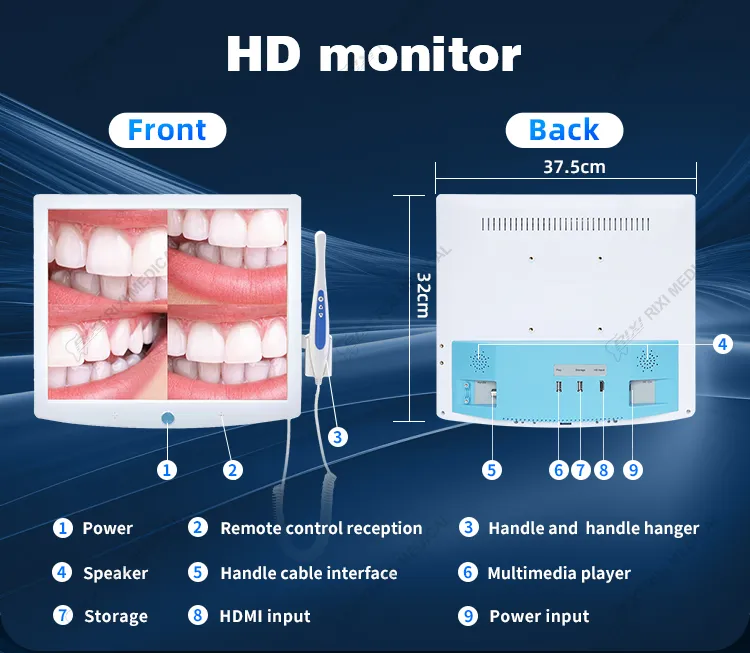 Dental Intraoral Camera Imaging