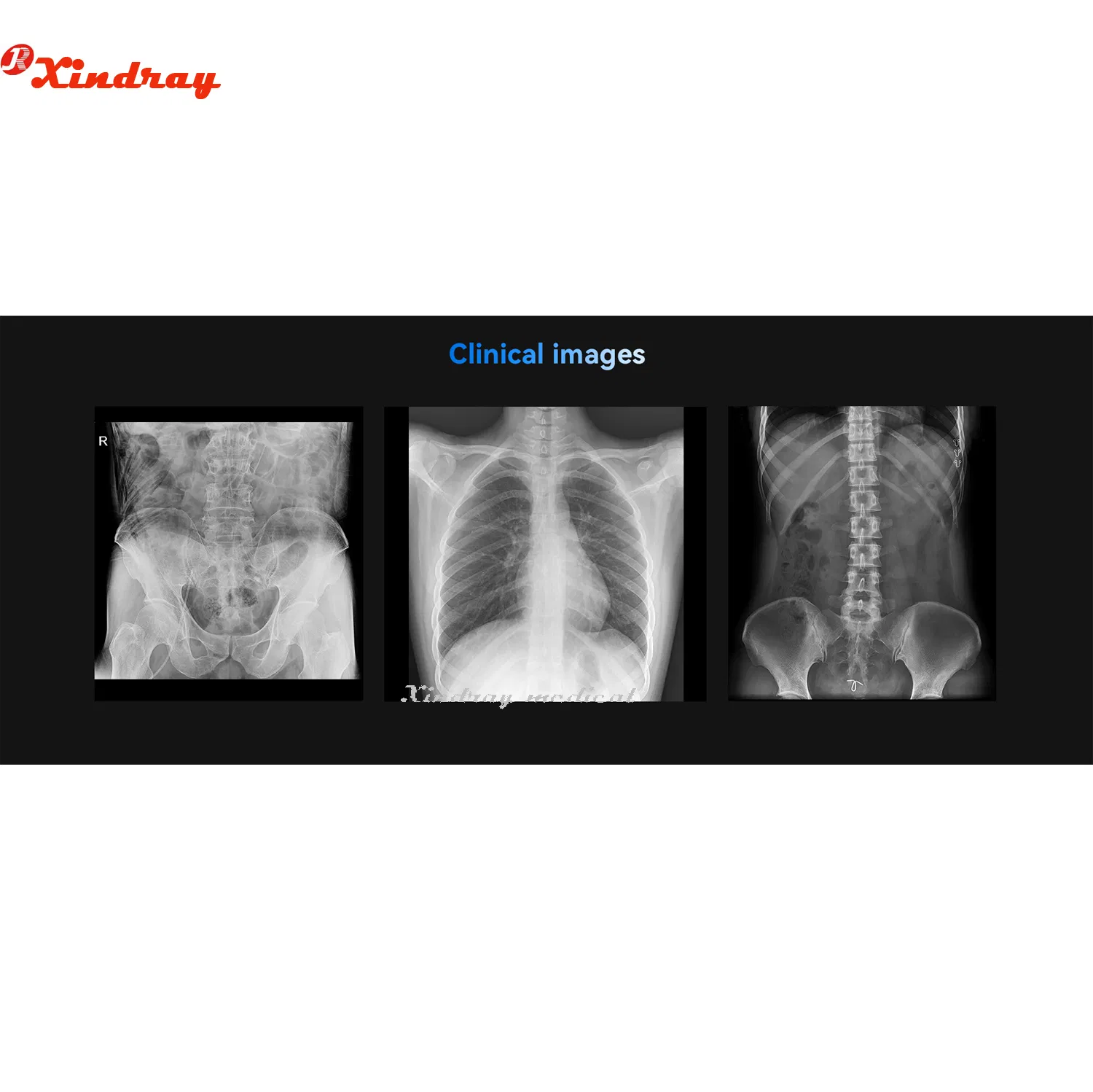 High Frequency Hospital Machine Medical Radiography Digital Mobile Portable X-ray Equipment