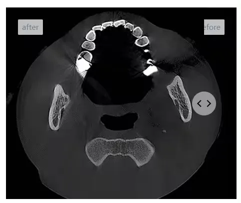 Correction technology