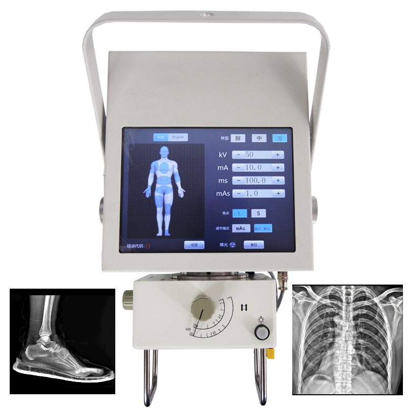 High-Precision Medical X-ray Equipment for Patient Care Solutions